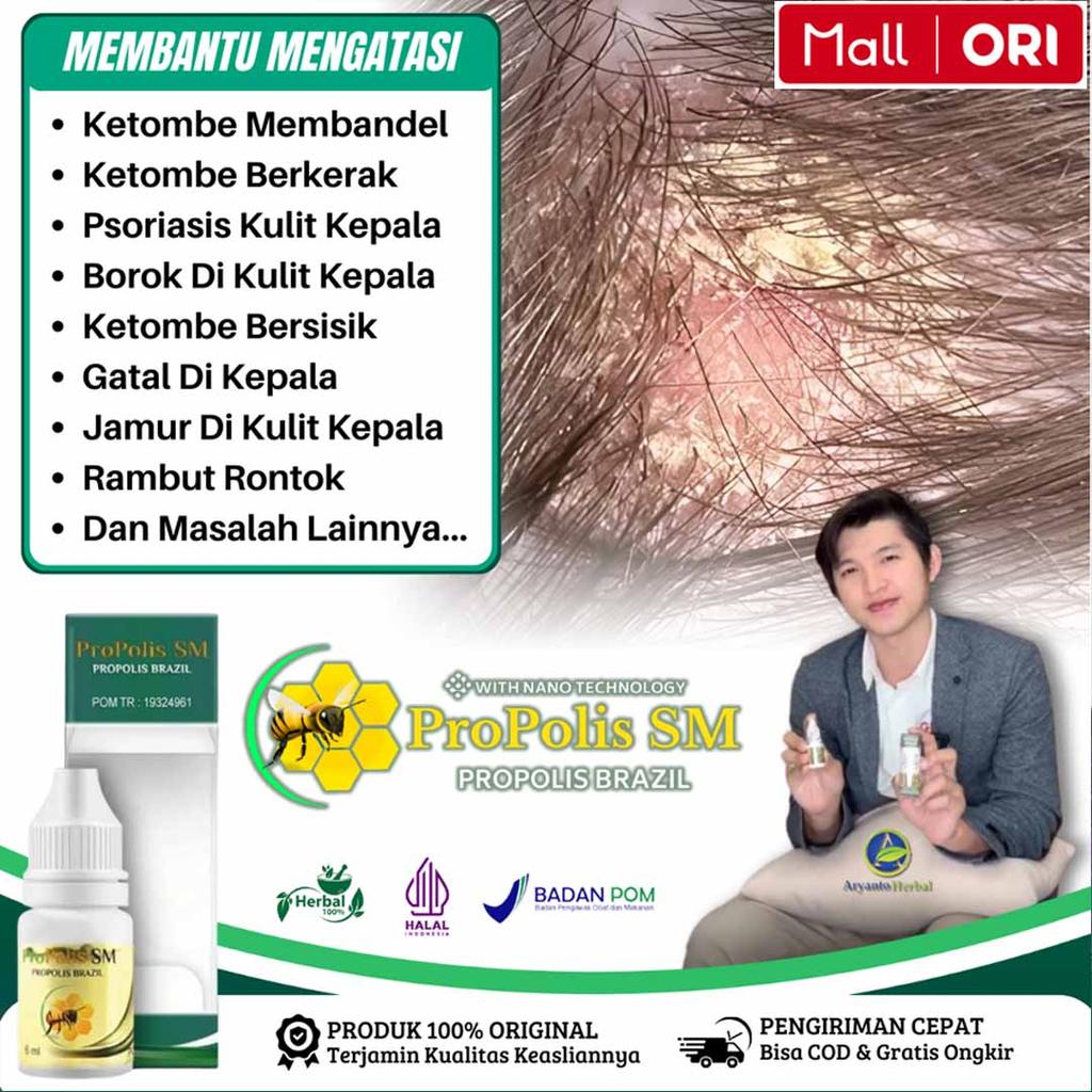 Obat Gatal Kulit Kepala, Ketombe Berkerak, Psoriasis Kepala, Borok dikepala, Koreng Luka Kepala mena