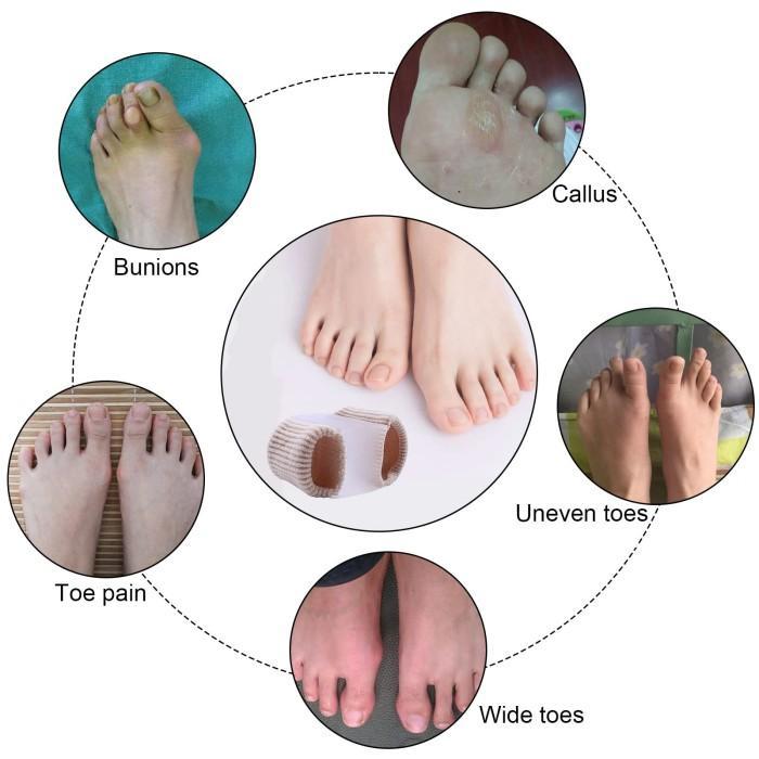 2Pcs Silikon Jari Kaki Toe Corrector Bunion Jempol Kaki Bengkok Pelurus Alat Pelurus Jempol Kaki