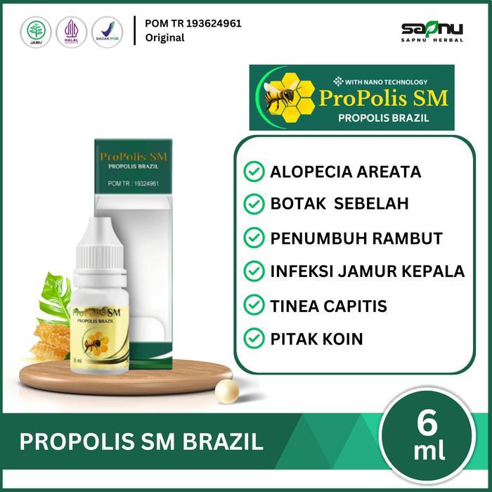 Propolis Sm Atasi Alopecia Areata, Oles Penumbuh Rambut Rontok, Infeksi Jamur Kepala