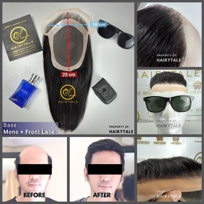 Toupee/tutup botak pria, natural 20cm, luas 22x15,Netting: mono + lace