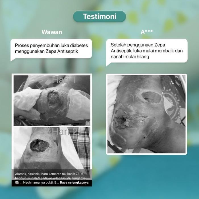 ANTISEPTIK ZEPA HOCL NON ALKOHOL 100ML