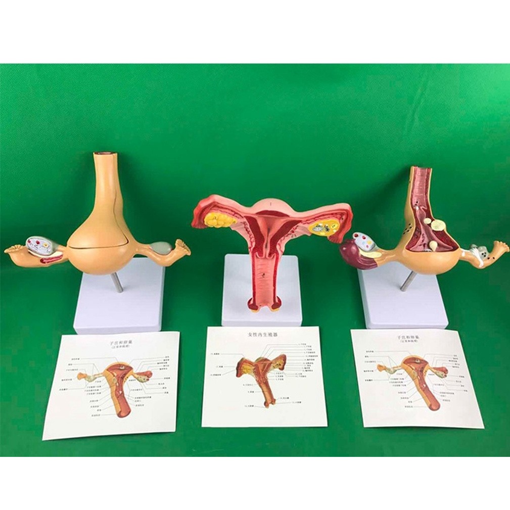 BEST PRICE Ovary and uterus disease Dissection model Pathology Female uterus model teaching human me