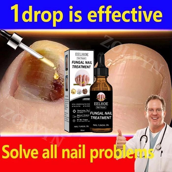 Obat Jamur Kuku Obat kuku jamur dan rusak Perawatan Kuku Berjamur Antibakteri Perawatan Kuku