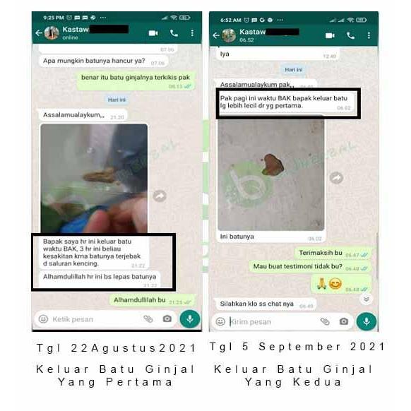 Obat Herbal Mazon B Dan K Muricata Original Obat Wasir Dan Ambeien Tbk