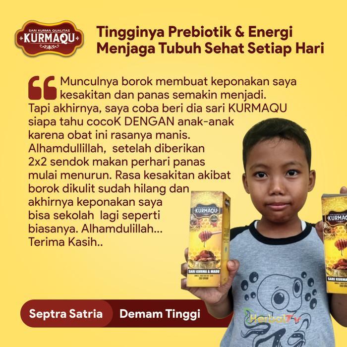 OBAT PENGGEMUK PIPI PIPI TEMBEM / CABI / CHUBBY TEMBEM KAN PIPI PENAMBAH BERAT BADAN PENAMBAH NAFSU