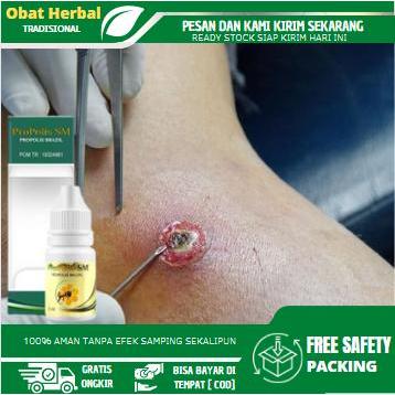 Flash Sale Cairan Tetes Perawatan Bisul Bernanah, Bisul Di Pantat, Bisul Ketiak, Penghilang Bisul,