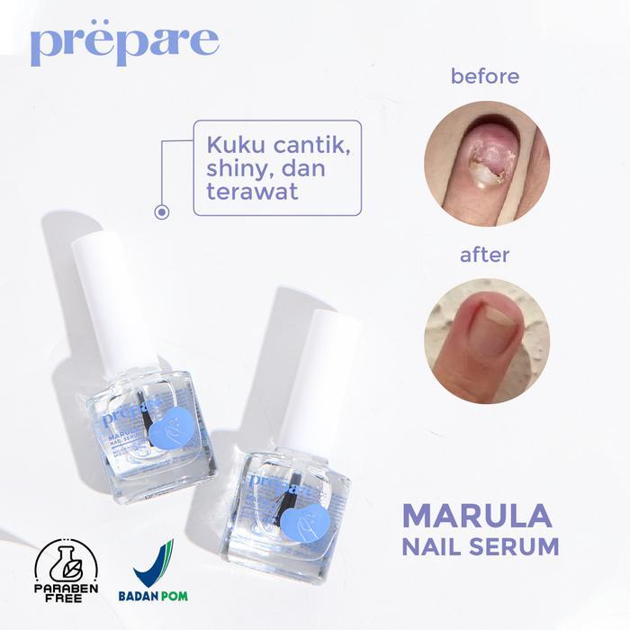 Kutikula Obat Jamur Kuku Vitamin Kuku Menghilangkan Cantengan Menghilangkan Jamur Pada Kuku Nail