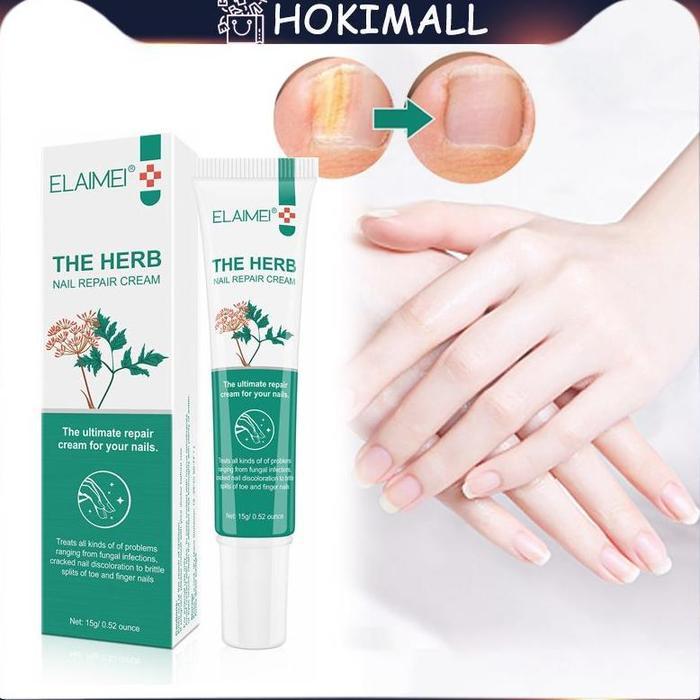 PERAWATAN JAMUR KUKU OBAT JAMUR KUKU PERAWATAN KUKU RUSAK REPAIR OBAT