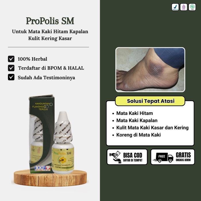 Propolis Sm Untuk Mata Kaki Hitam, Pemutih Mata Kaki, Mata Kaki Kapalan, Kulit Mata Kaki Kasar Dan