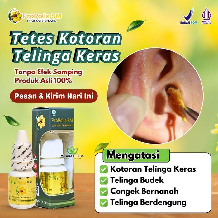 Tetes Telinga Herbal Pembersih Kotoran Telinga Keras Telinga Budek Dan Congek Propolis Sm Tetes
