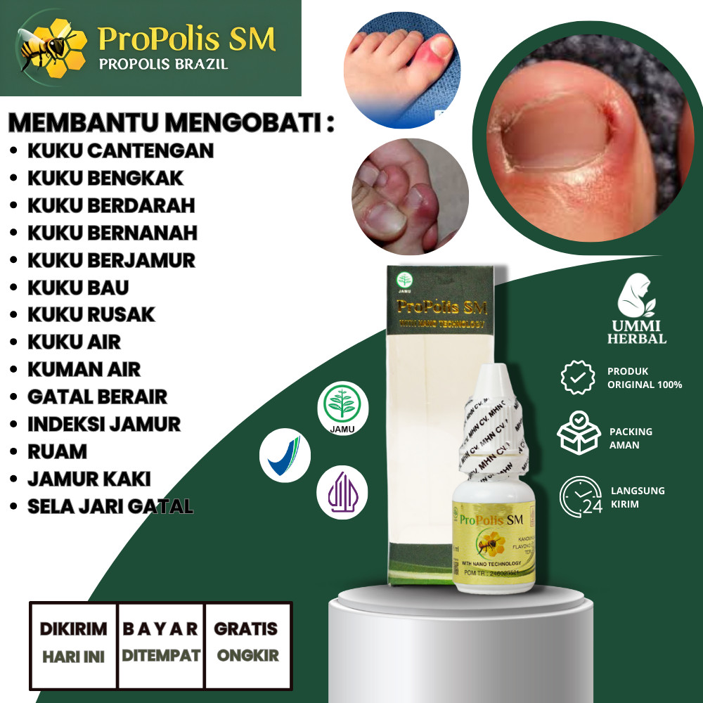 Propolis SM Cantengan Jempol Kaki Kaki bau Kuku Berjamur Kuku Bengkak - Propolis Sm Original