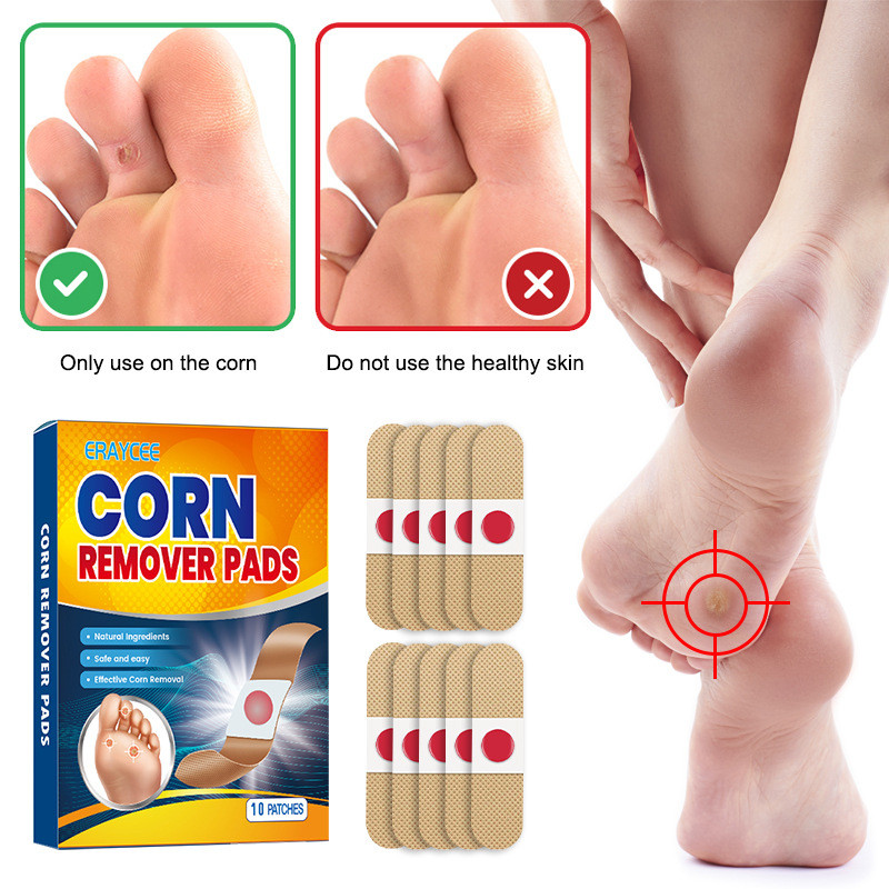 Foot Corn Remover Cream Chicken Eye Skin Infection Treatment Ointment Feet Dead Skin Calluses