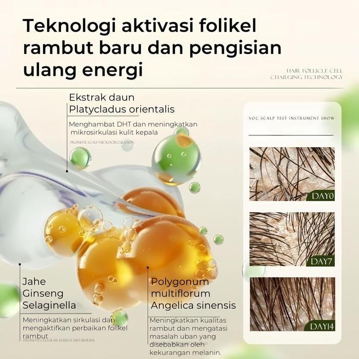 Remimpi Hair Loss Treatment Shampoo 300Ml3PcsHadiah Terbatas Remimpi Hair Tonic 50Ml