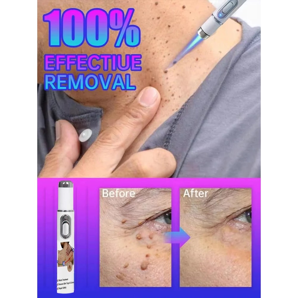 2025 hot Skin care pen, smooth body facial skin Keyou clean skin convenient operation care pen