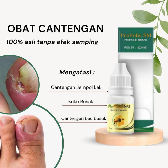 Tetes Kuku Cantengan, Vitamin Kuku Kaki Cantengan, Tetes Kuku Jempol Kaki Cantengan, Atasi Kuku