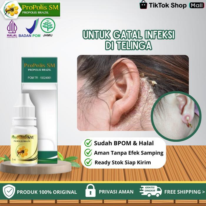 Propolis Sm - Untuk Penghilang Gatal Infeksi Di Daun Telinga, Gatal Budug Borok Psoriosis, Gatal