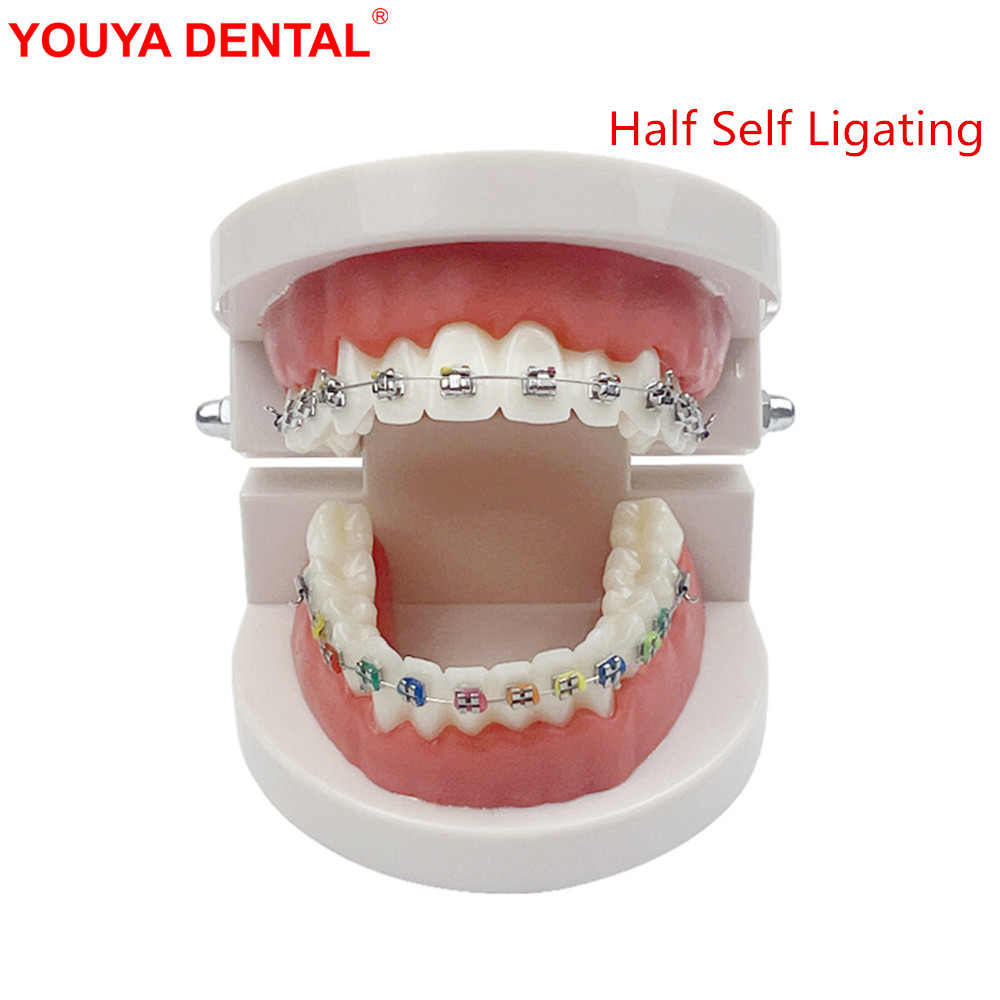 Olivcell Dental Typodont Orthodontic Model Half Self Ligating Normal Metal Bracket Comparison Ortho 