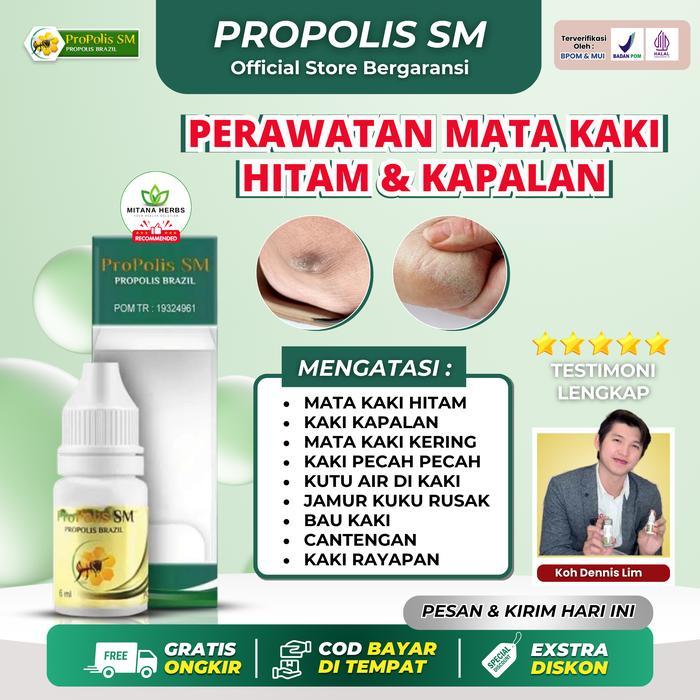 Propolis Sm Mata Kaki Hitam, Kaki Kapalan, Mata Kaki Hitam Dan Kering, Kaki Pecah Pecah, Mata Ikan