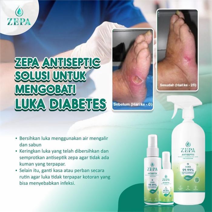ANTISEPTIC MENGOBATI LUKA PASCA OPERASI ZEPA HOCL 500ML+TRIGGER
