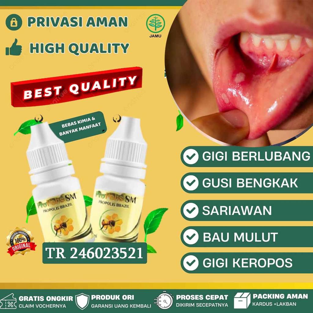 PROPOLIS SM Brazil 100% Asli Original Obat Sariawan Anak Aman Tidak Perih, Sariawan di Lidah, Sariaw