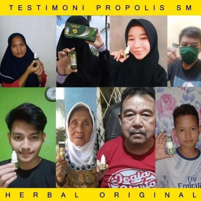 PROPOLIS SM - EKSIM KERING MENAHUN, EKSIM KERING, EKSIM BASAH, GATAL EKSIM, EKSIM MENAHUN, GATAL