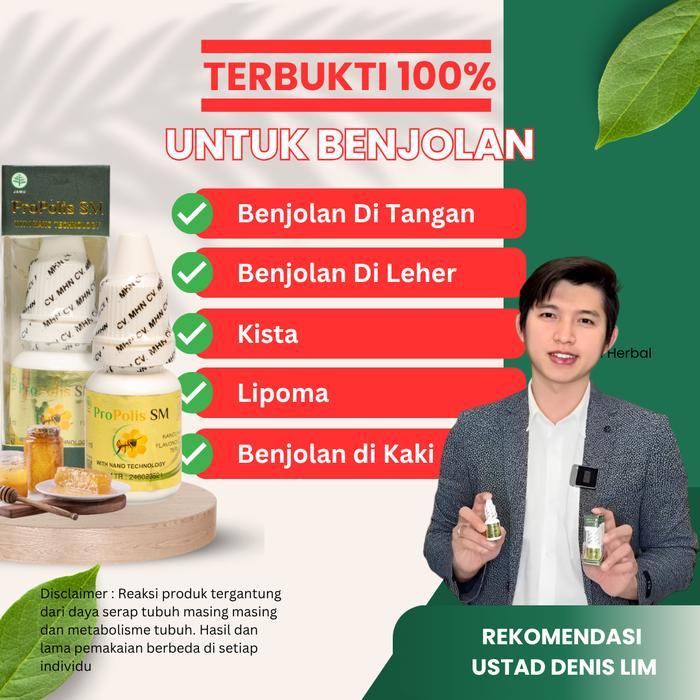 Obat Kelenjar Getah Bening, Benjolan Di Leher, Ketiak 100% Asli