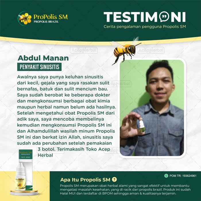 Ready Propolis Sm Suplemen Kesehatan Untuk Sinusitis Hidung Tersumbat Hidung Berbau Busuk Rhinitis