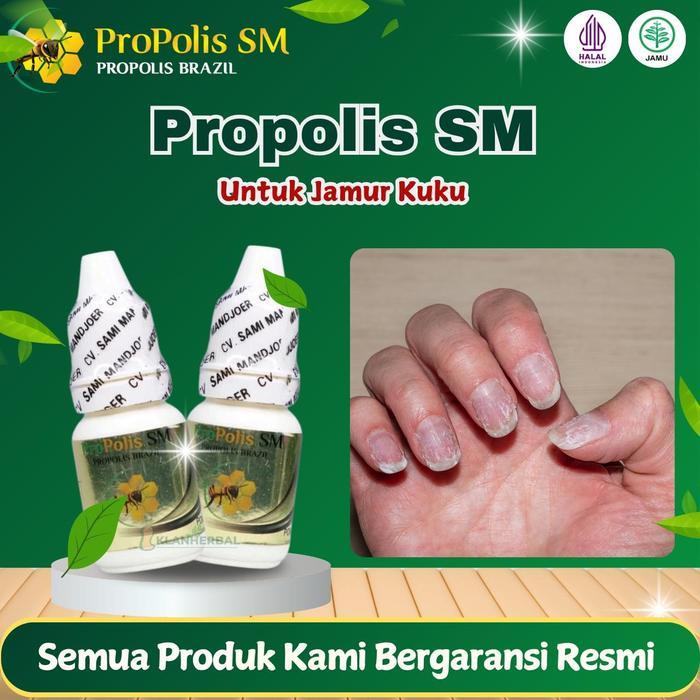 Jamur Kuku, Cantengan Jempol Kuku, Kuku Bernanah, Kuku Berair, Psoriasis Kuku Propolis Sm 6 Ml