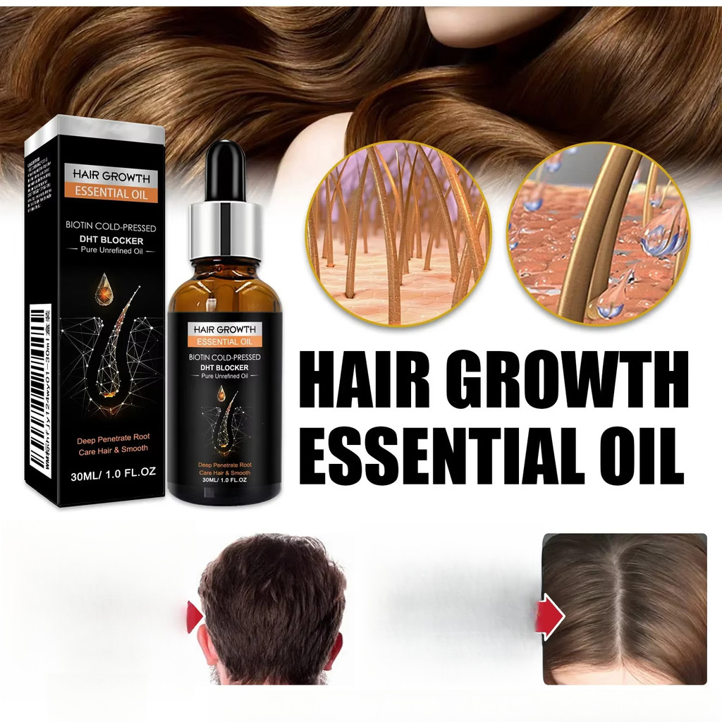 High Repurchase,Hair Growth Oil,Biotin DHT Blocker,Anti-Loss Shampoo,Boost Regrowth,Increase