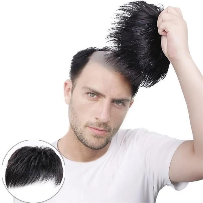Promo Wig Penutup Botak Pria Rambut Palsu Pria Rambut Simulasi Penutup Botak Depan Toupee Botak Pria