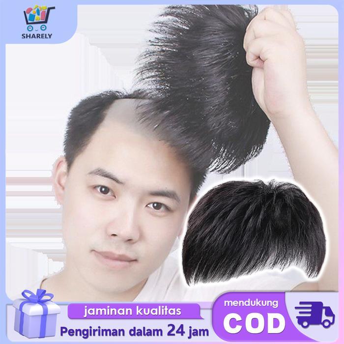 Rambut Palsu Pria Untuk Botak Wig Pria Botak Penutup Botak Sebagian Toupee Botak Depan Pria Hitam