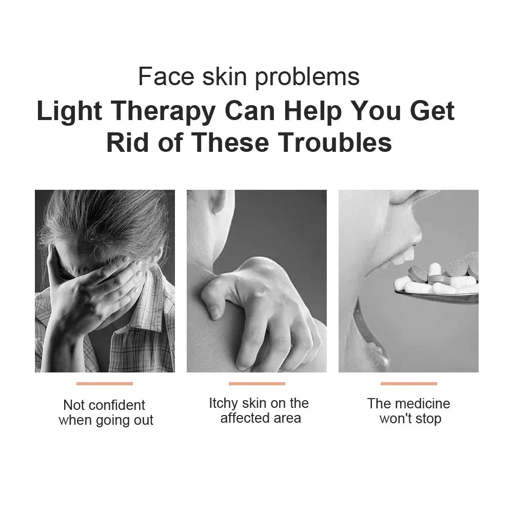 Vitiligo Phototherapy Device 311nm Uvb Lamp Narrowband Uvb Ultraviolet Phototherapy Lamp to Treat