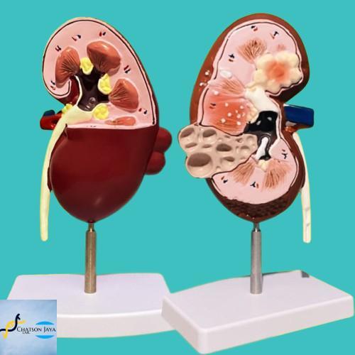 Alat Peraga Manekin Medical Anatomi Ginjal/Kerangka Ginjal Manusia