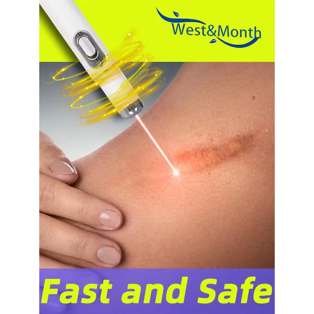 Laser therapy Keloid scar