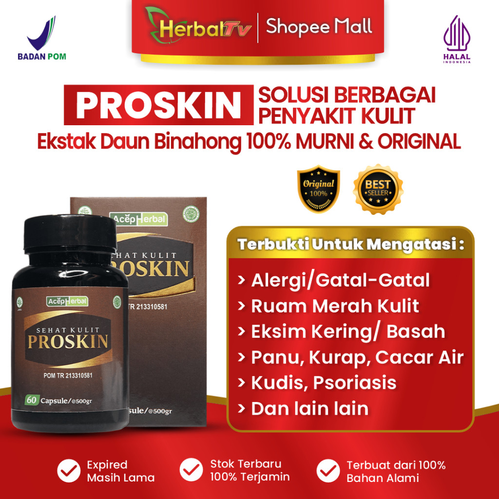 Obat Penghilang Cacar Air, Cacar Api, Cacar Ular, Cacar Monyet & Panas Dingin – PROSKIN