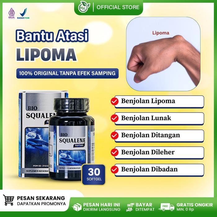 OBAT BENJOLAN LIPOMA DI KEPALA, PENGHANCUR BENJOLAN, BIO SQUALENE ASLI